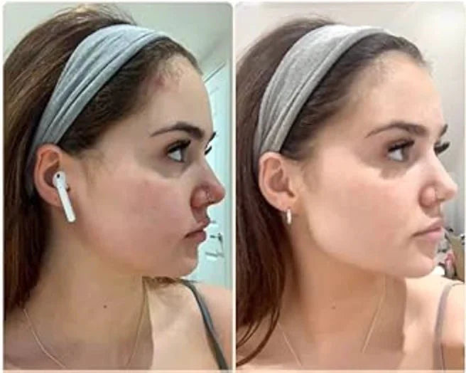 USB Rechargeable Face Massager | 4-in-1 Facial Beauty & Skincare Massage Device